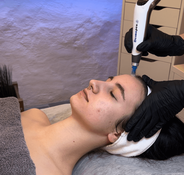 Microneedling med Dermapen