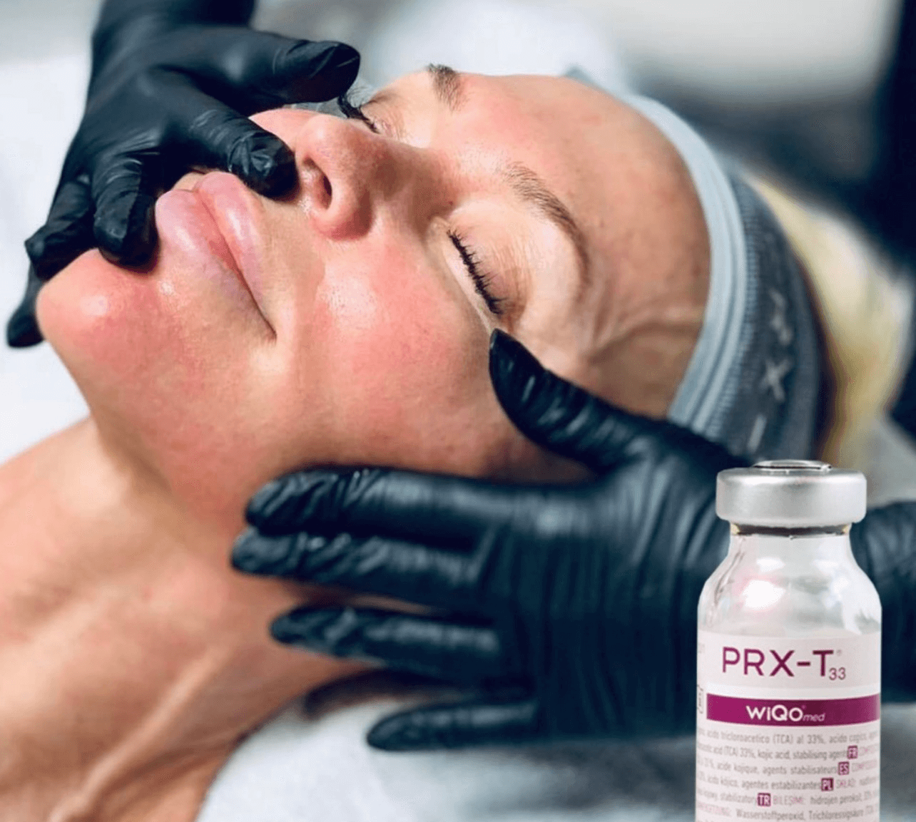 PRX-T33-behandling